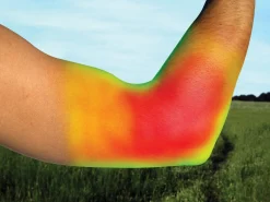 BACK ON TRACK BOT LL Back on Track® Elbow Brace- Braces